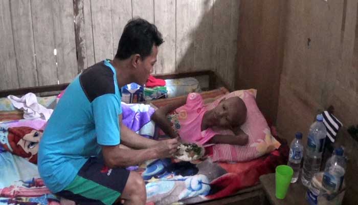 Melihat Ossy, Siswi SMP yang Divonis Kanker Tulang